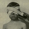 Short Listening Exam - Edward Temple's Eye Disorder